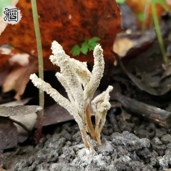 酒精肝