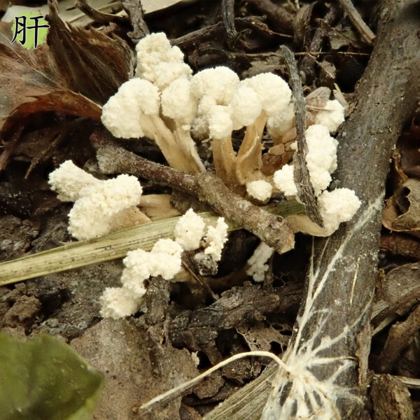 肝纤维化