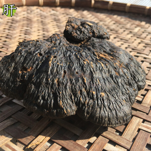 肝肾综合征