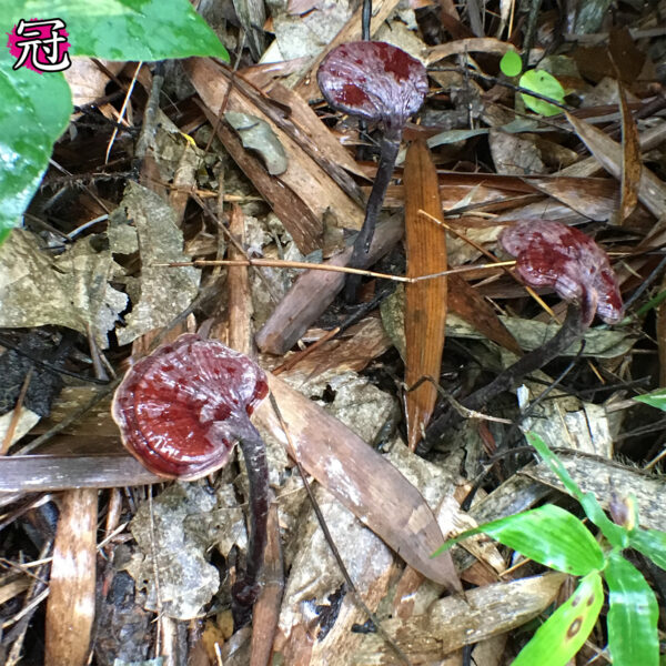 冠心病（人群差异）