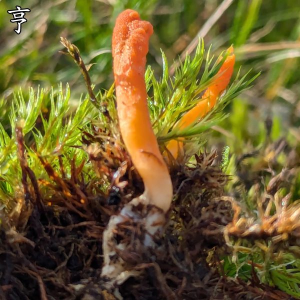 亨廷顿舞蹈病